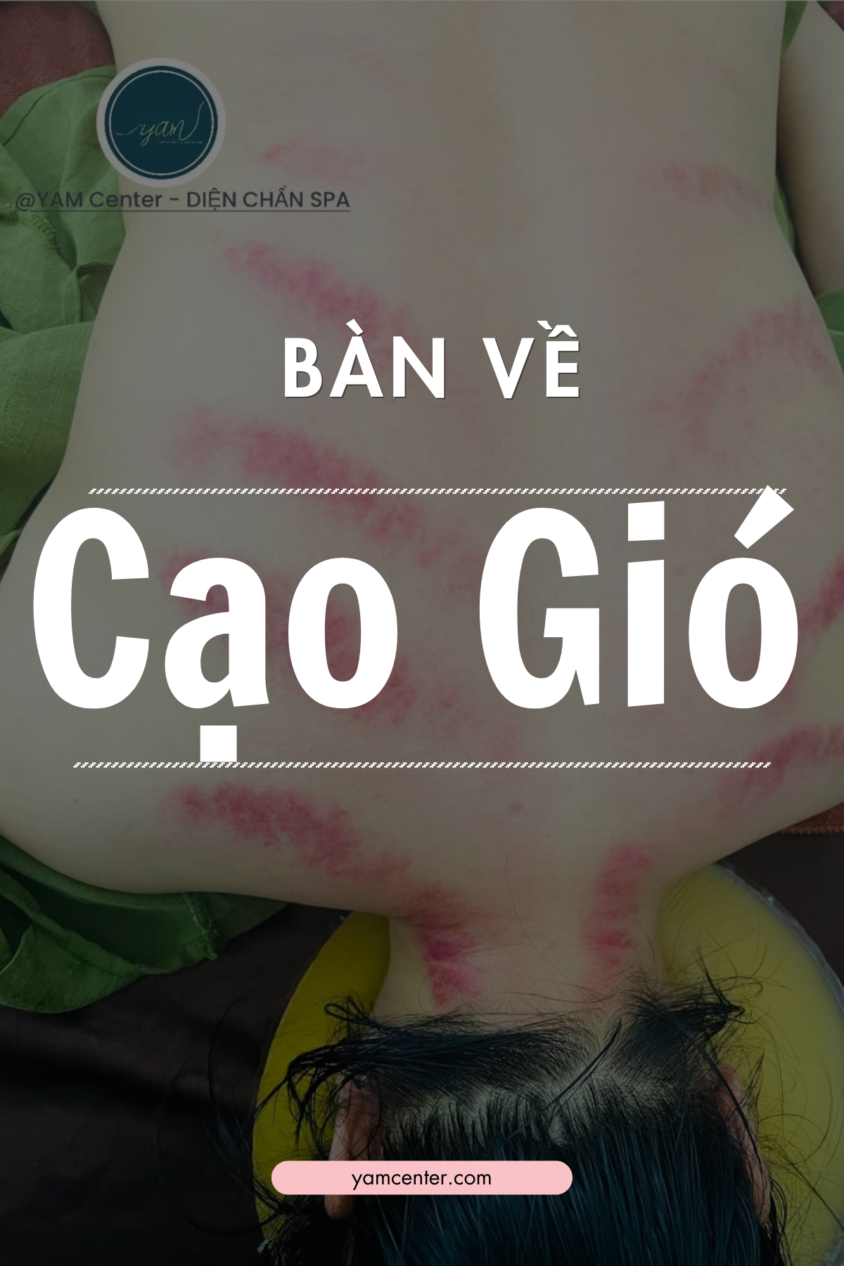 yamcenter cạo gió